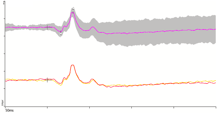 Normative Data wo boxes.png