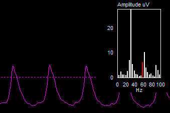 Table - FFT.png