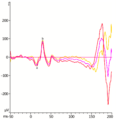 Hi n Lo - After.png