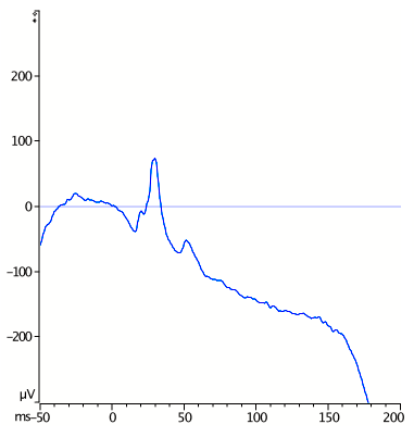 Toggle Trend -before 2.png