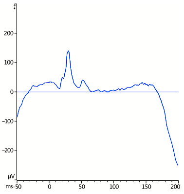 Toggle trend - after 2.png